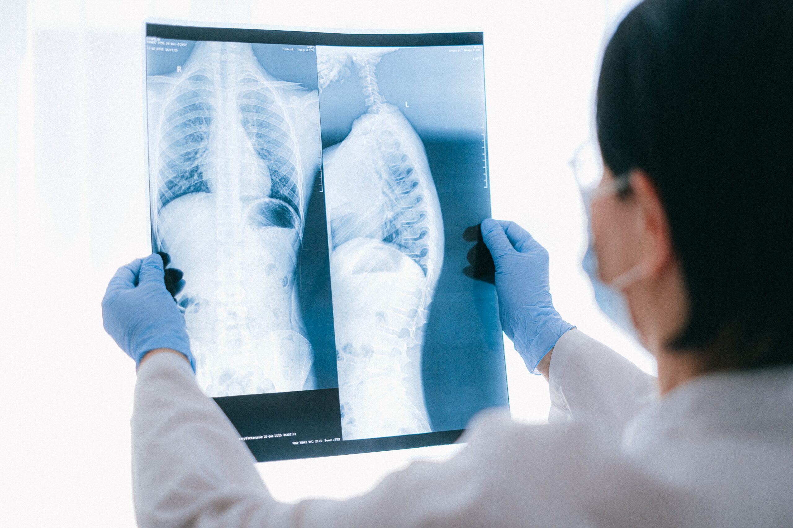 Spine Injury